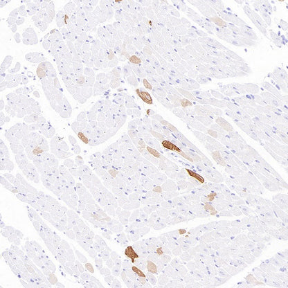 MYH7 Recombinant Rabbit mAb ,PBS Only (SDT-2936-44)
