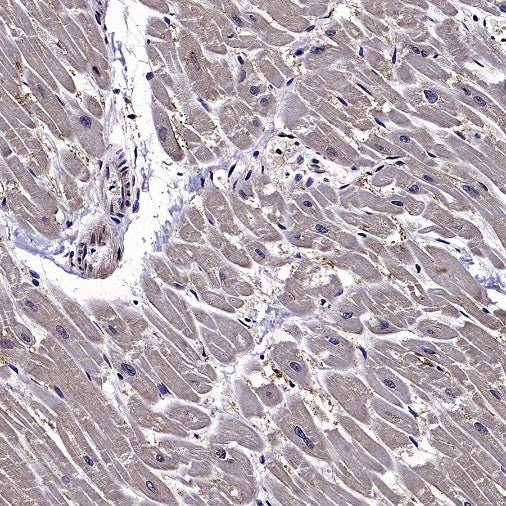 TRIM63 Recombinant Rabbit mAb (S-2304-110)