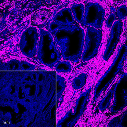 alpha smooth muscle Actin Recombinant Rabbit mAb (Alexa Fluor® 647 Conjugate) (SDT-132-63)