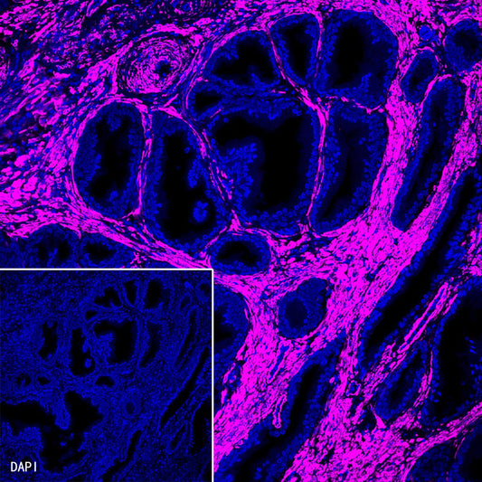 alpha smooth muscle Actin Recombinant Rabbit mAb (Alexa Fluor® 647 Conjugate) (SDT-132-63)