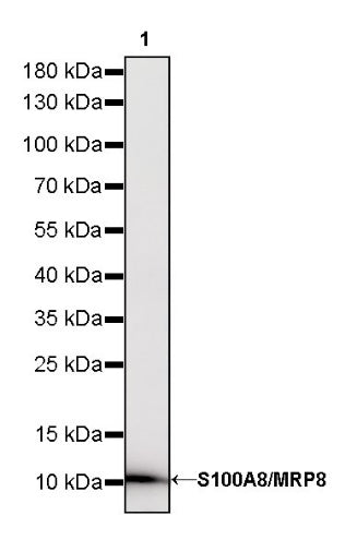 S100A8/MRP8 Recombinant Rabbit mAb (S-R251)
