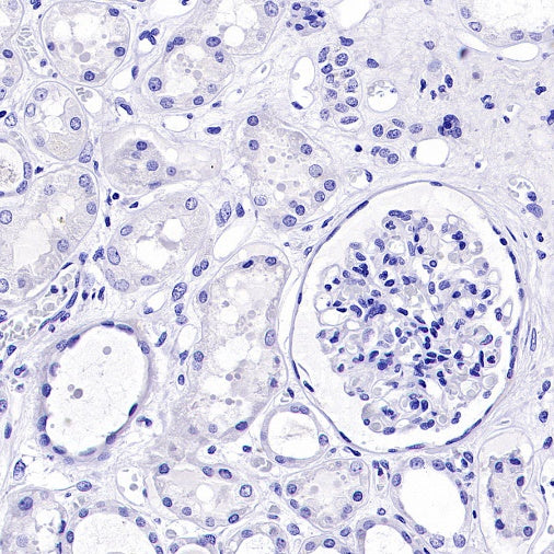 Osteocalcin Recombinant Rabbit mAb (SDT-2311-37)