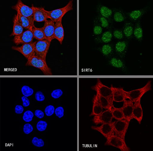 SIRT6 Recombinant Rabbit mAb (S-885-56)