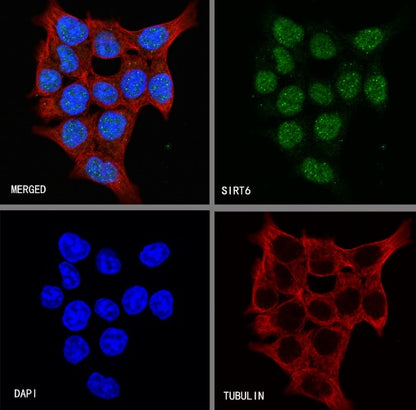SIRT6 Recombinant Rabbit mAb (S-885-56)