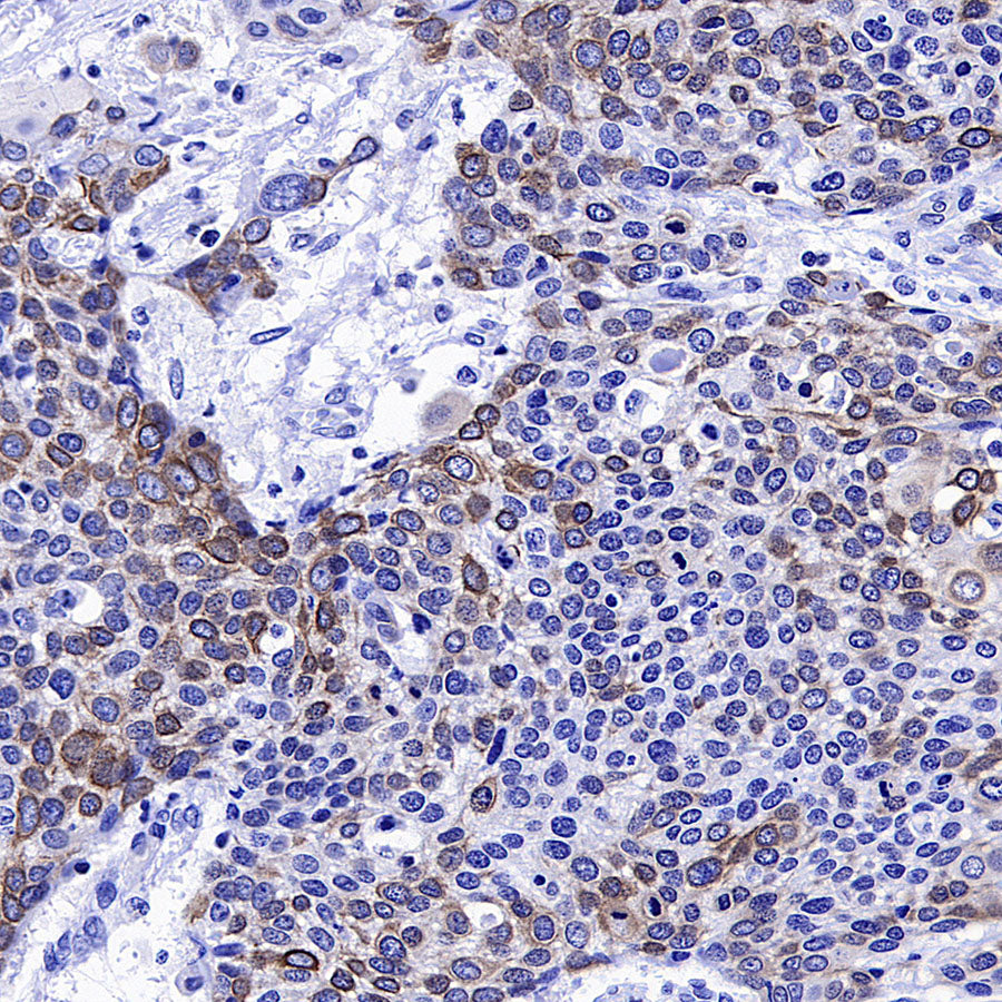 CXCR4 Recombinant Rabbit mAb (S-5318)