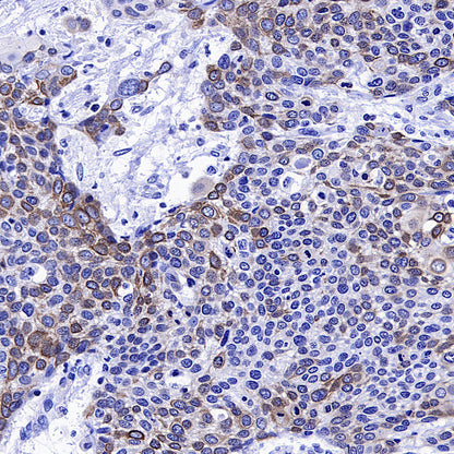 CXCR4 Recombinant Rabbit mAb (S-5318)