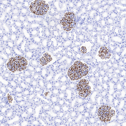 Nestin Recombinant Rabbit mAb (S-3890-61)