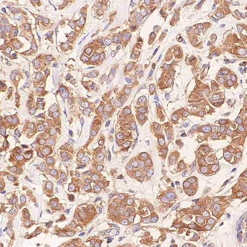 Glycogen Synthase Recombinant Rabbit mAb (S-2698-24)
