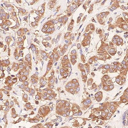 Glycogen Synthase Recombinant Rabbit mAb (S-2698-24)