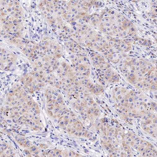 WWOX Recombinant Rabbit mAb (S-R298)