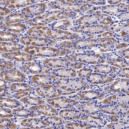 SOD2/MnSOD (acetyl K68) Rabbit Polyclonal Antibody