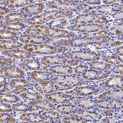 SOD2/MnSOD (acetyl K68) Rabbit Polyclonal Antibody
