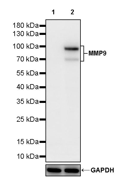 MMP9 Recombinant Rabbit mAb (S-3915-36)