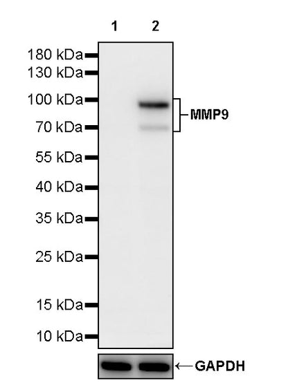 MMP9 Recombinant Rabbit mAb (S-3915-36)