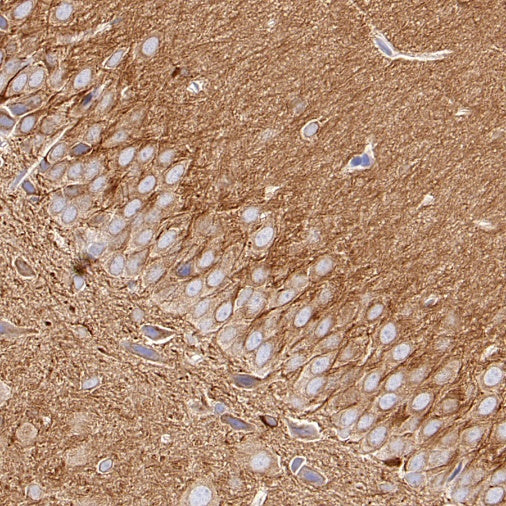 Beta IV Tubulin Recombinant Rabbit mAb (S-1572-30)