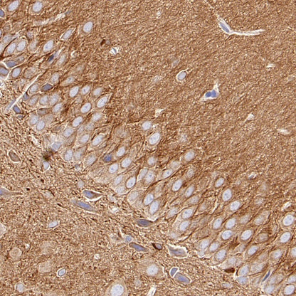 Beta IV Tubulin Recombinant Rabbit mAb (S-1572-30)