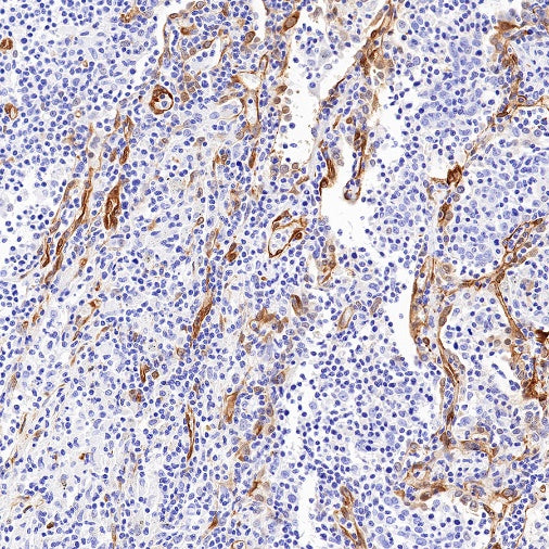 EHD2 Recombinant Rabbit mAb (S-1580-60)