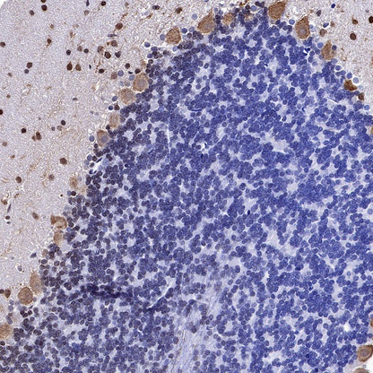 Parvalbumin Recombinant Rabbit mAb (S-1620-10)