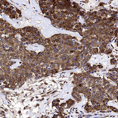 YB1 Recombinant Rabbit mAb (S-1748-144)