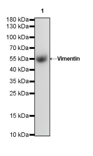 Vimentin Recombinant Rabbit mAb (SDT-029-120)