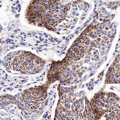 SDHB Recombinant Rabbit mAb (SDT-1162-2)