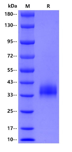 SARS-CoV-2 (BA.2.86/Omicron) RBD (V483), His tag