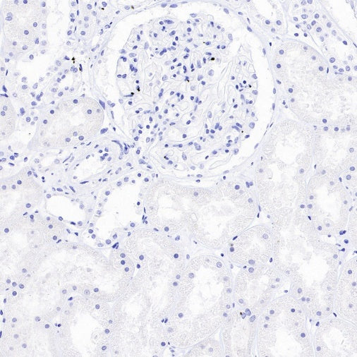 ASCL1/MASH1 Recombinant Rabbit mAb (SDT-3517-121)