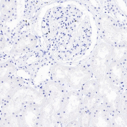 ASCL1/MASH1 Recombinant Rabbit mAb (SDT-3517-121)