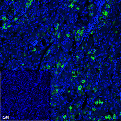 FSHB Recombinant Rabbit mAb (SDT-R287)