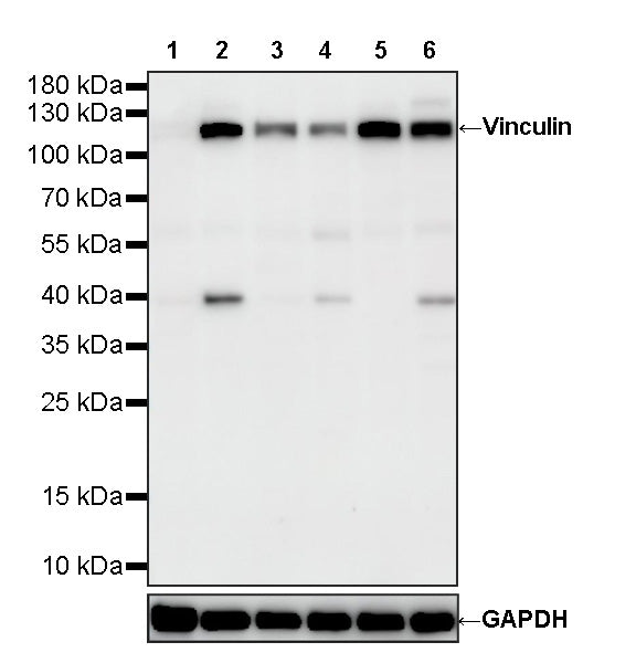 Vinculin Recombinant Rabbit mAb (S-5405)