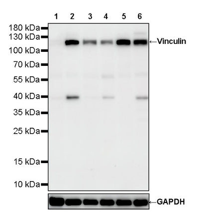 Vinculin Recombinant Rabbit mAb (S-5405)
