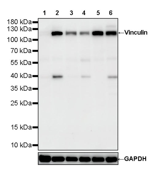 Vinculin Recombinant Rabbit mAb (S-5405)