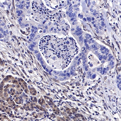 SMAD4 Recombinant Rabbit mAb (SDT-168-62)