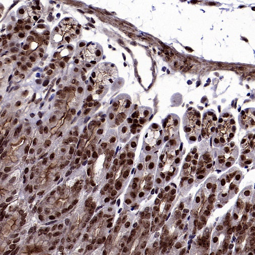 MBD3 Rabbit Polyclonal Antibody