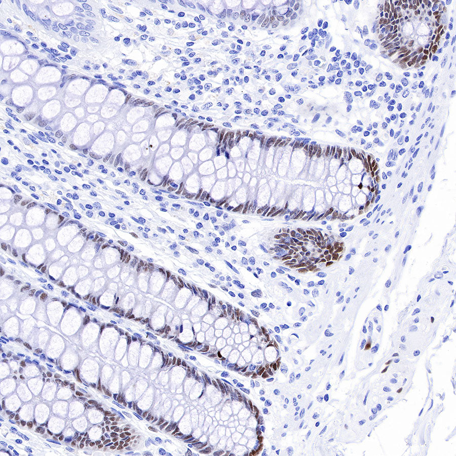 SOX9 Recombinant Rabbit mAb (SDT-019-29)