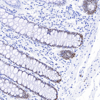 SOX9 Recombinant Rabbit mAb (SDT-019-29)