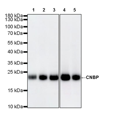CNBP Recombinant Rabbit mAb (S-4288-3)