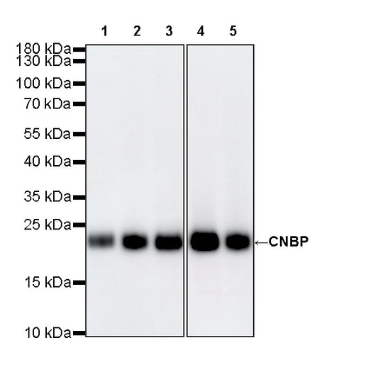 CNBP Recombinant Rabbit mAb (S-4288-3)