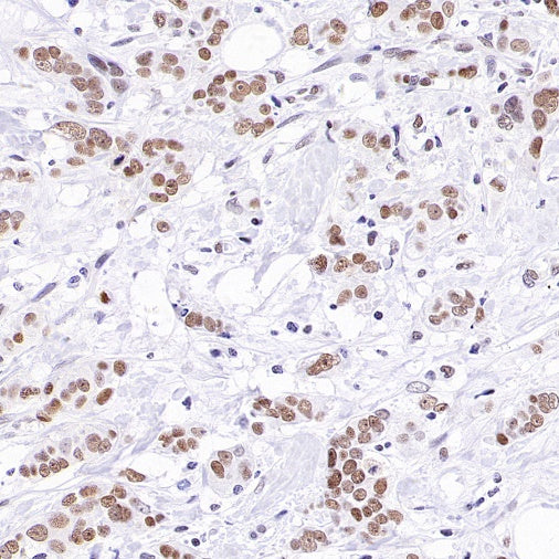 Caspase-8 Recombinant Rabbit mAb (S-2676-74)