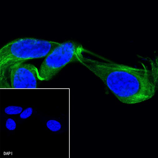 β-tubulin Recombinant Rabbit mAb (Alexa Fluor® 488 Conjugate) (S-312-113)
