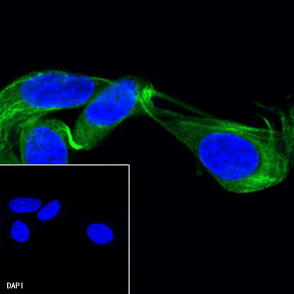 β-tubulin Recombinant Rabbit mAb (Alexa Fluor® 488 Conjugate) (S-312-113)