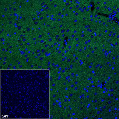 KCC2 Recombinant Rabbit mAb (S-3044-2)