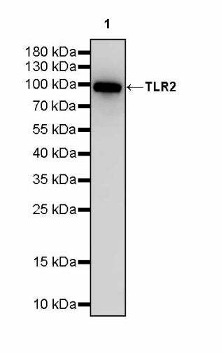TLR2 Recombinant Rabbit mAb (S-2585-57)