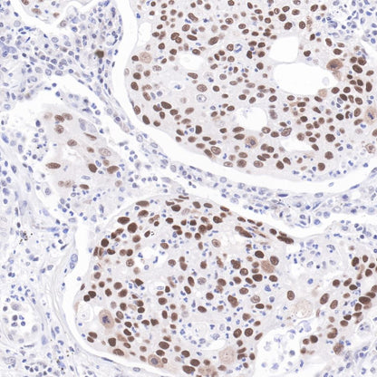 p53 Recombinant Rabbit mAb (SDT-100-72)