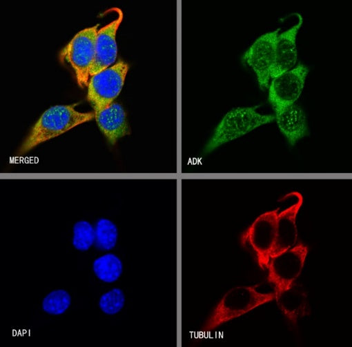 ADK Rabbit Polyclonal Antibody
