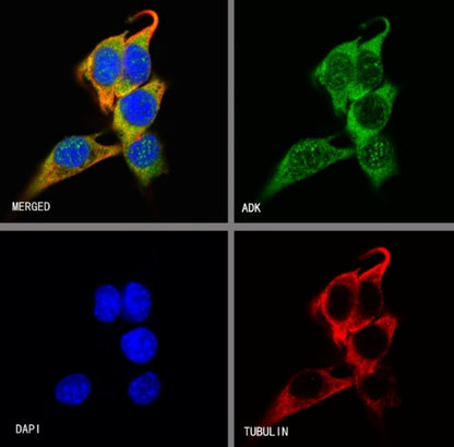 ADK Rabbit Polyclonal Antibody