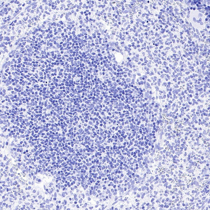 Pan Trk Recombinant Rabbit mAb (SDT-400-39)
