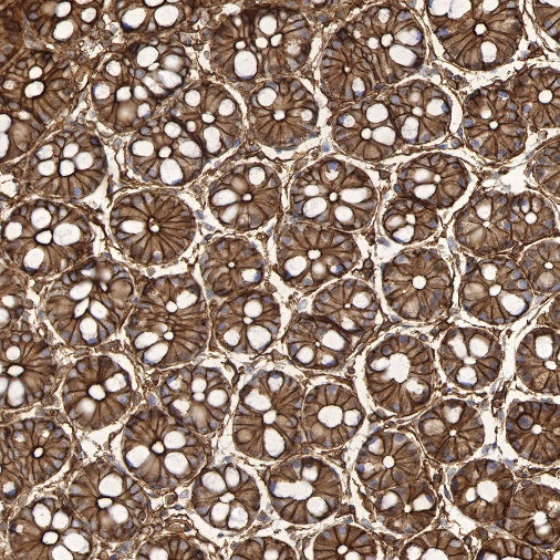 S-RMab®Annexin A2 Recombinant Rabbit mAb (SDT-444-67)