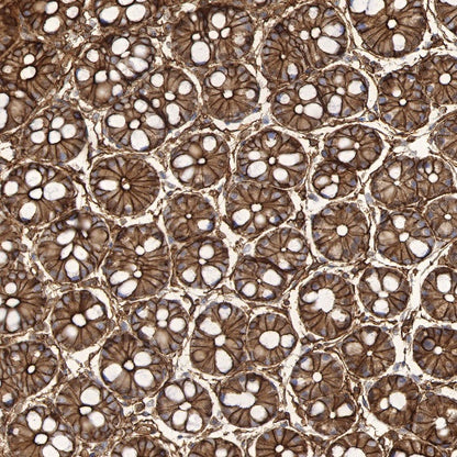 S-RMab®Annexin A2 Recombinant Rabbit mAb (SDT-444-67)