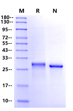 Recombinant Enterokinase, His tag (High specific activity)
